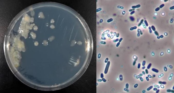 Azotobacter vinelandii - vi khuẩn được thiết kế để nâng cao năng suất cây trồng và bảo vệ môi trường